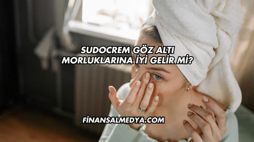 Sudocrem Göz Altı Morluklarına İyi Gelir mi?