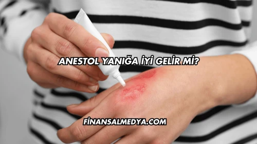 Anestol Yanığa İyi Gelir mi?