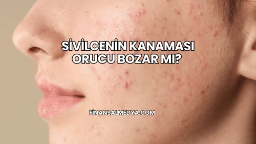 Sivilcenin Kanaması Orucu Bozar mı?