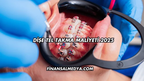 Dişe Tel Takma Maliyeti 2025