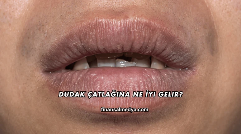 Dudak Çatlağına Ne İyi Gelir?
