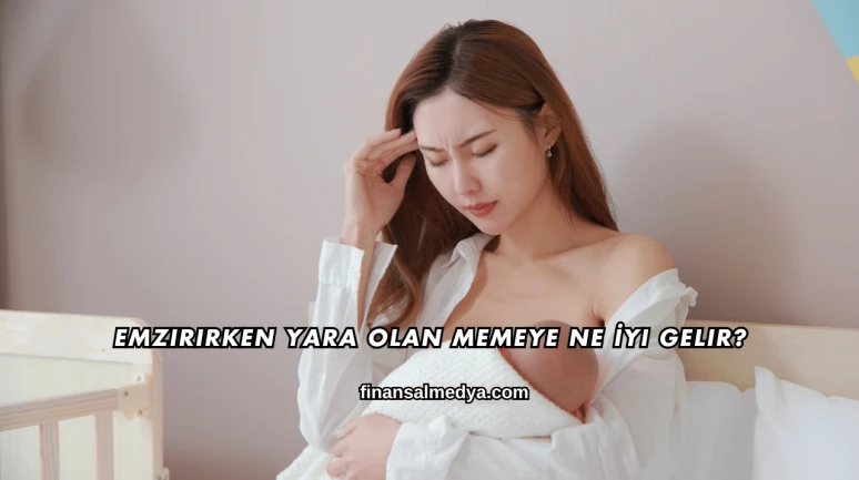 Emzirirken Yara Olan Memeye Ne İyi Gelir?