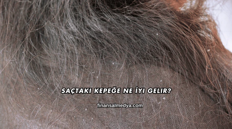 Saçtaki Kepeğe Ne İyi Gelir?