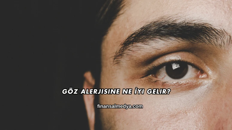 Göz Alerjisine Ne İyi Gelir?
