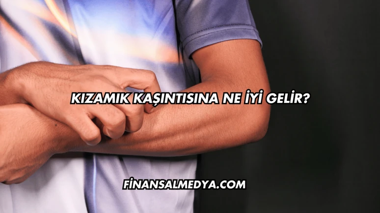 Kızamık Kaşıntısına Ne İyi Gelir?