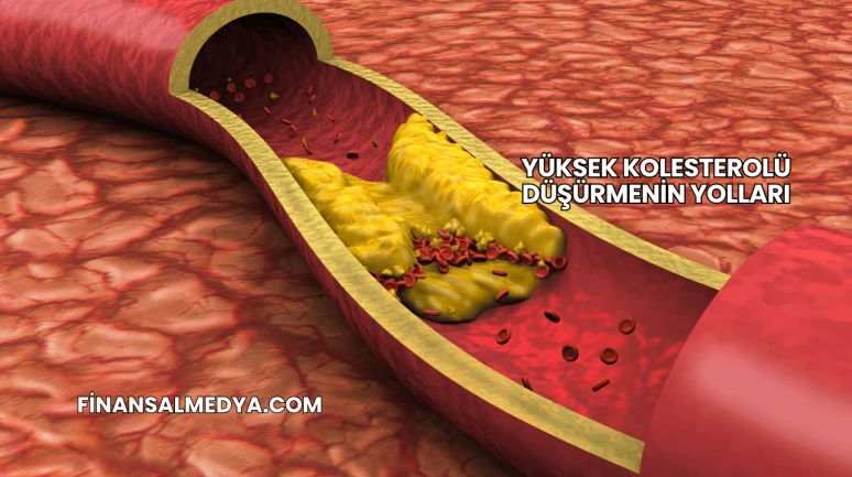 Yüksek Kolesterolü Düşürmenin Yolları