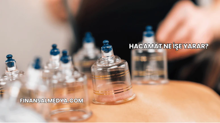 Hacamat Ne İşe Yarar?
