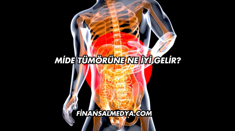 Mide Tümörüne Ne İyi Gelir?