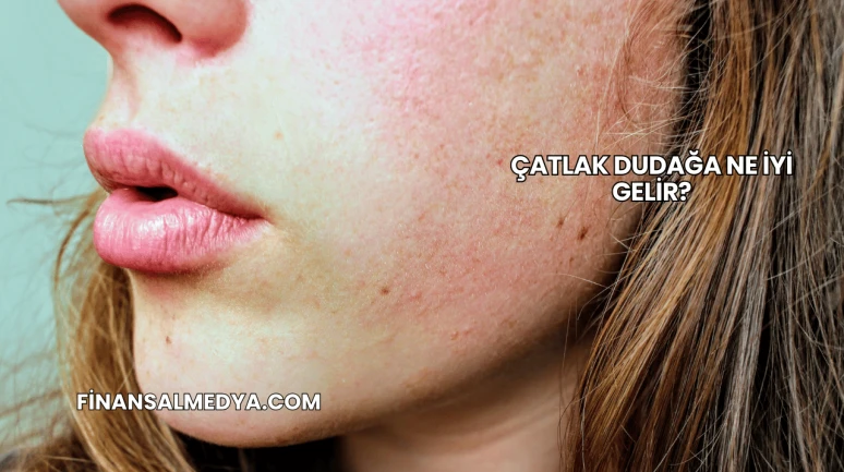Çatlak Dudağa Ne İyi Gelir?
