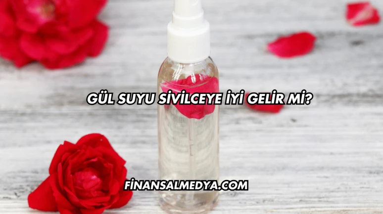 Gül Suyu Sivilceye İyi Gelir mi?