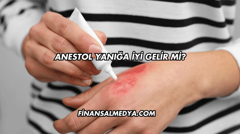 Anestol Yanığa İyi Gelir mi?