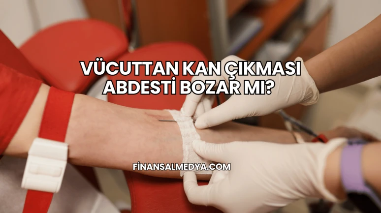 Vücuttan Kan Çıkması Abdesti Bozar mı?