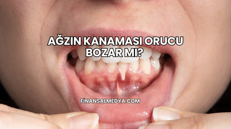 Ağzın Kanaması Orucu Bozar mı?