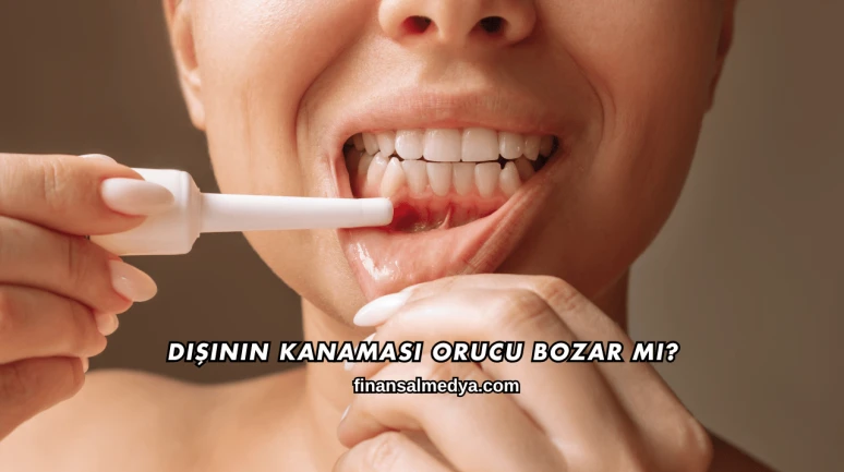 Dişinin Kanaması Orucu Bozar mı?