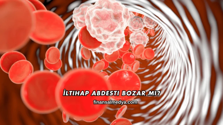 İltihap Abdesti Bozar mı?